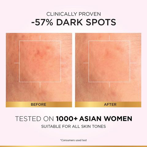L'Oreal Paris Glycolic Bright Instant Glowing Serum 30ml - Anti-Dark, Spot Brightening Face Serum
