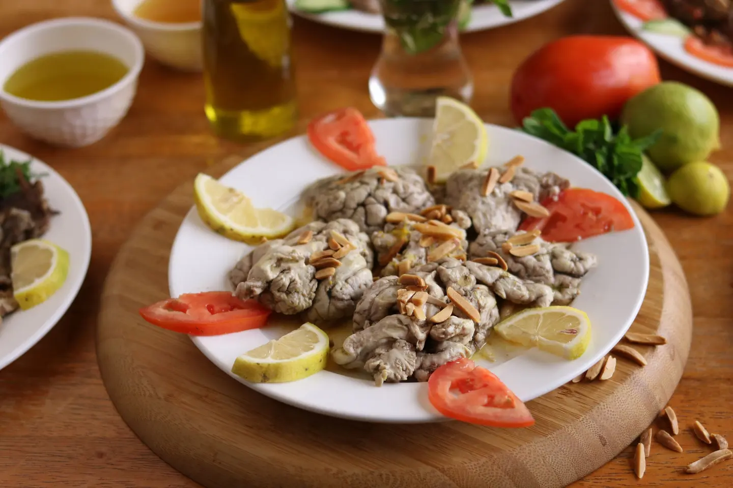 صحن مخ