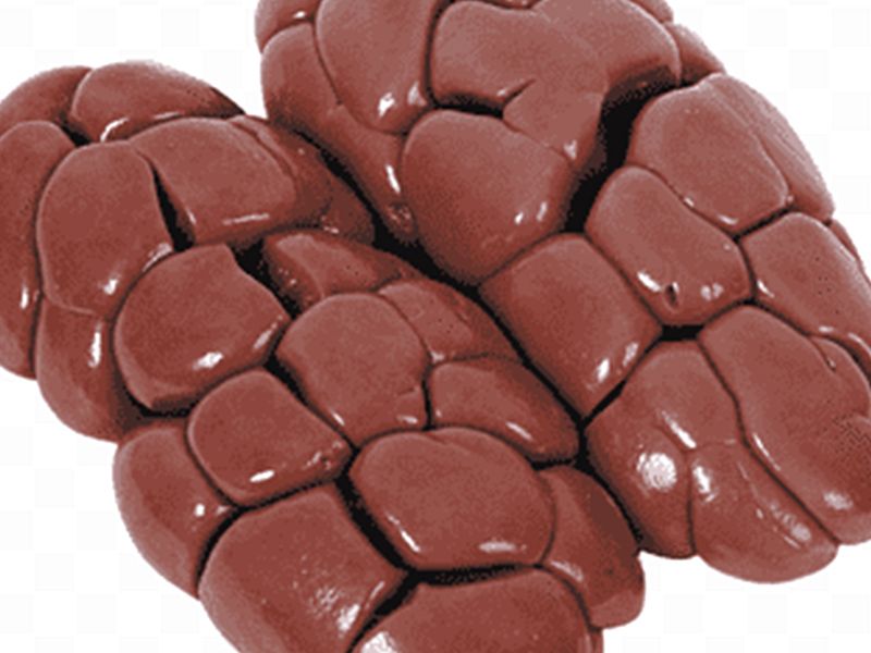 Kidney